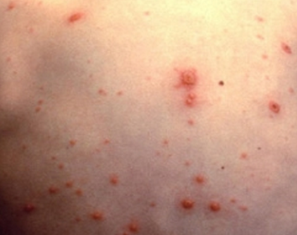 tiny red spots on skin #10