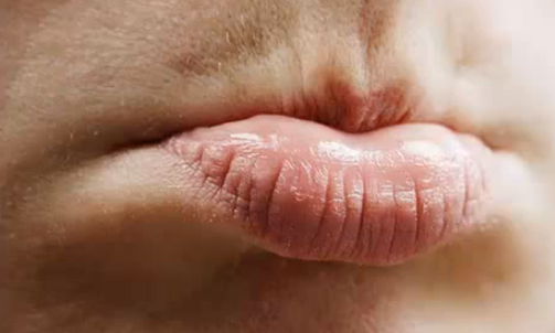 First Outbreak Symptoms of Mouth Herpes - livestrong.com